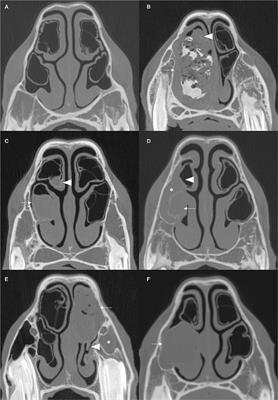 Computed Tomographic Assessment of Individual Paranasal Sinus Compartment and Nasal Conchal Bulla Involvement in 300 Cases of Equine Sinonasal Disease